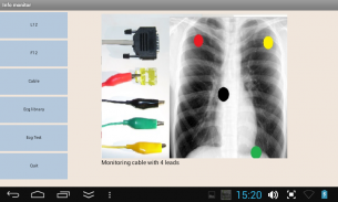 Mobile patient monitoring screenshot 4