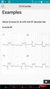 ECGCardio screenshot 0