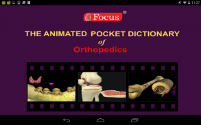 Orthopedics - Medical Dict. screenshot 5