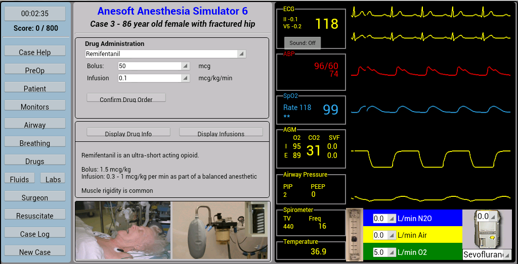 Anesthesia Sim 6 | Download APK for Android - Aptoide
