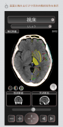 CT PassportLite Head/Brain MRI sectional anatomy screenshot 0