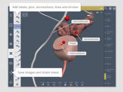 Male Pelvis: 3D RT - Sub screenshot 6