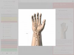 Acupuncture 3D screenshot 3