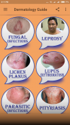 Dermatology Guide screenshot 3