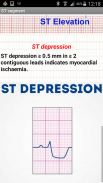 Easy ECG screenshot 2