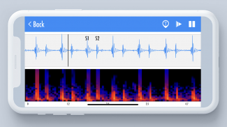 Stemoscope: Digital Stethoscop screenshot 1