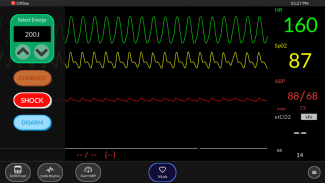 Simpl - Simulated Patient Monitor screenshot 3