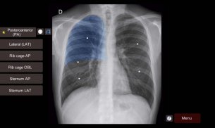 Radiographic Anatomy X-Ray screenshot 7