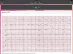 ECG Master: Quiz & Explanation screenshot 7