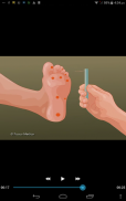 AQR - Diabetic Foot screenshot 5