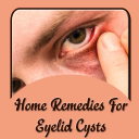 Remedies For Eyelid Cysts Icon