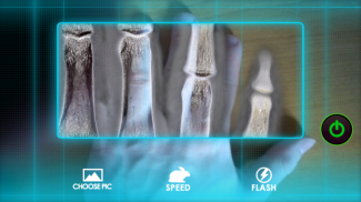 X-Ray Scanner: Augmented Prank screenshot 2