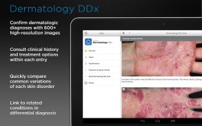 Dermatology DDx screenshot 5