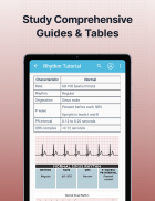 ECG EKG Interpretation Mastery screenshot 12