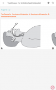 Poisoning & Drug Overdose Info screenshot 6