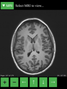 MRI Viewer screenshot 5