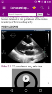 Echocardiography screenshot 4