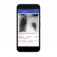 Chest Radiology screenshot 6