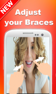 Braces Camera Selfie - Photo Editor screenshot 0