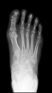 X-ray Scanner Prank screenshot 4