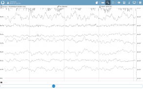 NeuroCenter EEG screenshot 1