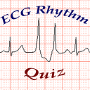 ECG Rhythm Quiz