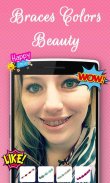 Braces Colors Beauty screenshot 2