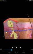 Dermatology - Medical Dict. screenshot 5