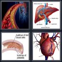 Blood Disease & Treatment