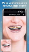 Teeth Braces Photo Booth screenshot 0