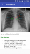 Chest X-Ray Based Cases screenshot 3