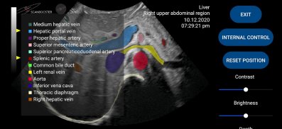 Scanbooster Ultrasound Sim screenshot 5