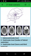 CT Brain screenshot 1