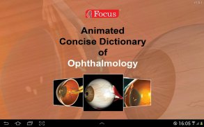 Ophthalmology- Dictionary screenshot 0
