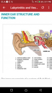 Ear Infection screenshot 0