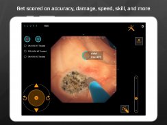 Gastro Ex: Played by Gastroent screenshot 3