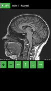 MRI Viewer screenshot 1