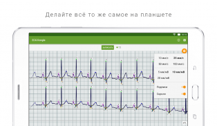 ECG Dongle screenshot 6