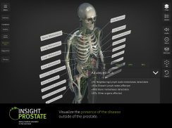 INSIGHT PROSTATE screenshot 12