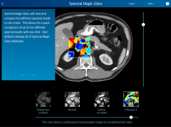 Philips IQon Spectral CT Fundamentals. screenshot 1