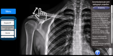 Radiographic Anatomy X-Ray screenshot 5