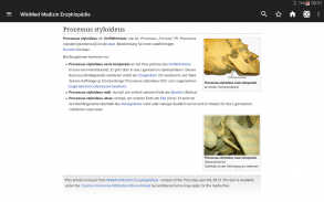 Wikipedia Medizin (Offline) screenshot 3