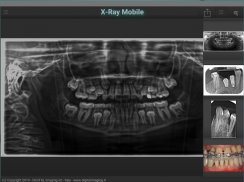 X-Ray Mobile screenshot 0