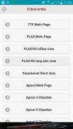 EchoCardio screenshot 0
