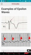 ECGCardio screenshot 9