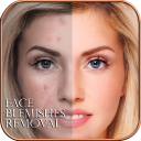 Face Blemishes Remover Icon