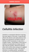 Cellulitis Infection screenshot 6