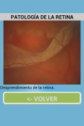 Oftalmología screenshot 5