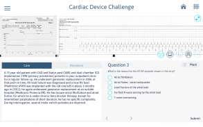 Cardiac Device Challenge screenshot 5