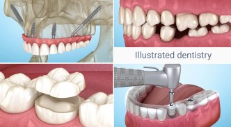 Dental 3D Illustrations screenshot 14